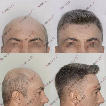 1B40 1B65 Мужские человеческие волосы Парик Система замены волос Капиллярный протез Натуральный волосяной покров Прочный полностью кожаный мужской парик